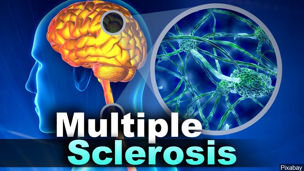 The MS mystery in Syracuse: Why do we have highest rate of multiple sclerosis nationwide? - CNYcentral.com thumbnail