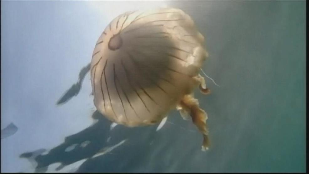 Jellyfish stings on the rise at Oak Island during Labor day WCTI